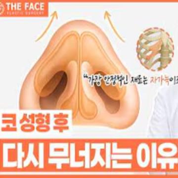 코성형 후 다시 무너지는 이유